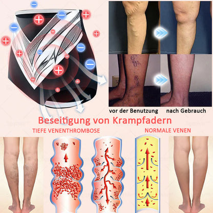 𝐒𝐠𝐪𝐭𝐡𝐡𝐫® 👩‍⚕️ Sculpting-Hose aus Tourmalin-Titan - 💎 Perfekte Silhouette, Frauen-Gesundheitspflege   🔥 Letzter Tag 🔥 70 % Rabatt