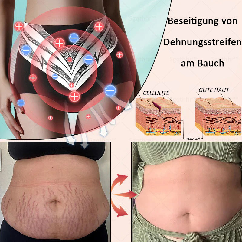 𝐒𝐠𝐪𝐭𝐡𝐡𝐫® 👩‍⚕️ Sculpting-Hose aus Tourmalin-Titan - 💎 Perfekte Silhouette, Frauen-Gesundheitspflege   🔥 Letzter Tag 🔥 70 % Rabatt