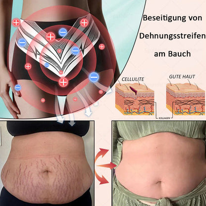 𝐒𝐠𝐪𝐭𝐡𝐡𝐫® 👩‍⚕️ Sculpting-Hose aus Tourmalin-Titan - 💎 Perfekte Silhouette, Frauen-Gesundheitspflege   🔥 Letzter Tag 🔥 70 % Rabatt