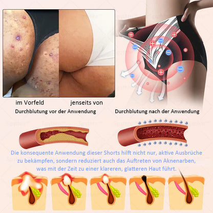 𝐒𝐠𝐪𝐭𝐡𝐡𝐫® 👩‍⚕️ Sculpting-Hose aus Tourmalin-Titan - 💎 Perfekte Silhouette, Frauen-Gesundheitspflege   🔥 Letzter Tag 🔥 70 % Rabatt