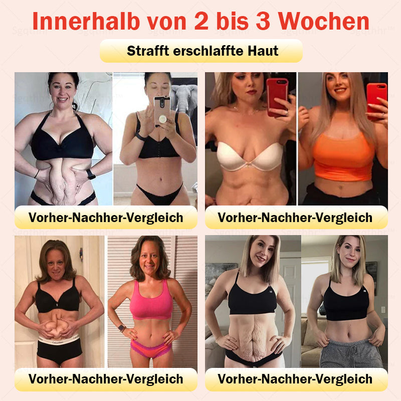 𝐒𝐠𝐪𝐭𝐡𝐡𝐫® 👩‍⚕️ Sculpting-Hose aus Tourmalin-Titan - 💎 Perfekte Silhouette, Frauen-Gesundheitspflege   🔥 Letzter Tag 🔥 70 % Rabatt