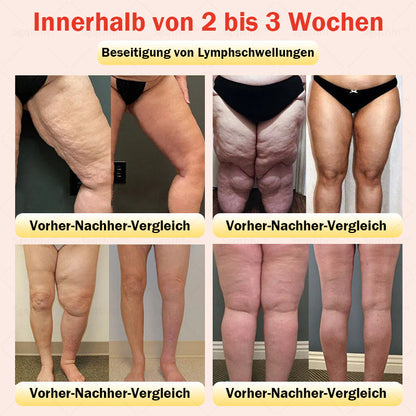 𝐒𝐠𝐪𝐭𝐡𝐡𝐫® 👩‍⚕️ Sculpting-Hose aus Tourmalin-Titan - 💎 Perfekte Silhouette, Frauen-Gesundheitspflege   🔥 Letzter Tag 🔥 70 % Rabatt